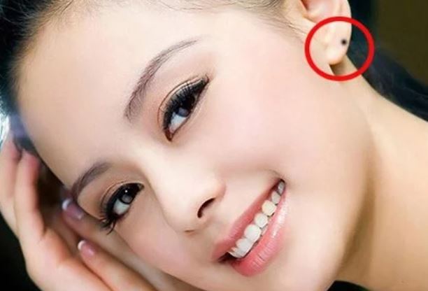 Các cụ dạy: Trên mặt có 9 nốt ruồi quý hơn vàng, sở hữu 1/9 cũng đủ may mắn, hồng phúc sâu dày