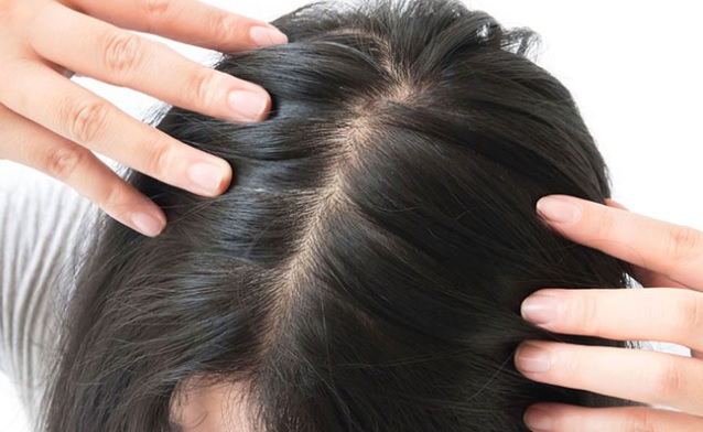 Lý do không ngờ khiến da đầu có mùi hôi