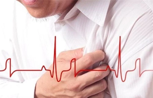 Những điều bạn cần biết về bệnh rối loạn nhịp tim