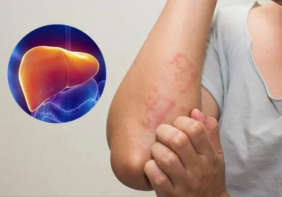 4 vùng trên cơ thể bị đau cảnh báo bệnh gan đã đi vào giai đoạn nặng, cần được cứu chữa kịp thời