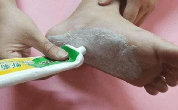 Bôi kem đánh răng vào kẽ chân, tưởng phí phạm mà lại có tác dụng diệu kỳ