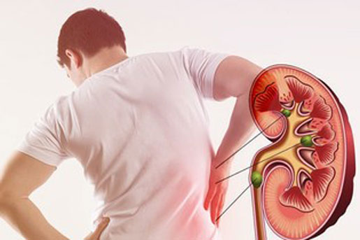 Những sai lầm khi ăn uống khiến thận phải ‘kêu cứu’, ai cũng ít nhất một lần mắc phải