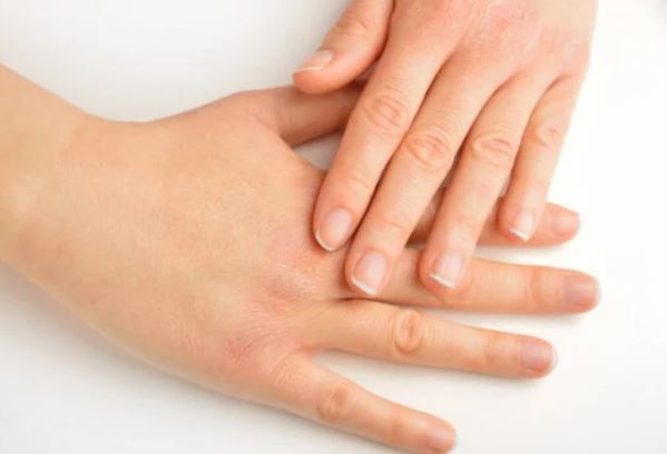 Bàn tay xuất hiện 5 điều này là dấu hiệu cảnh báo suy thận, tuyệt đối không nên bỏ qua