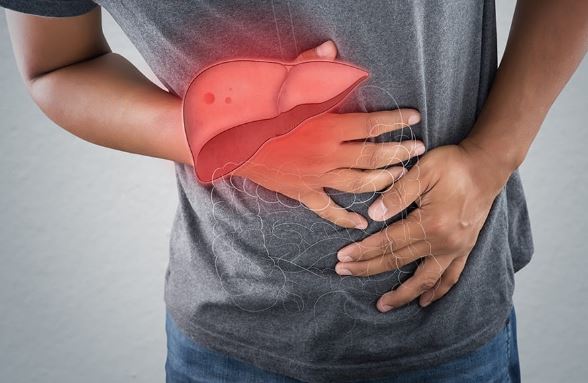 Thảo dược tốt cho người gan nhiễm mỡ