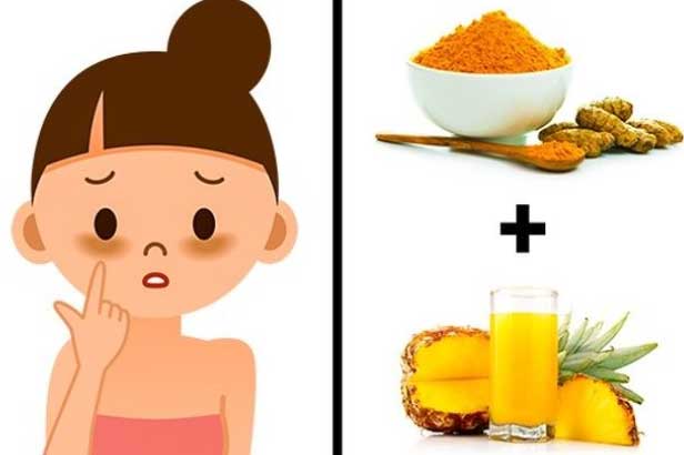 Mụn, nám da, vết thâm hay nếp nhăn đều bị đánh bay bởi những mẹo đơn giản, dễ làm