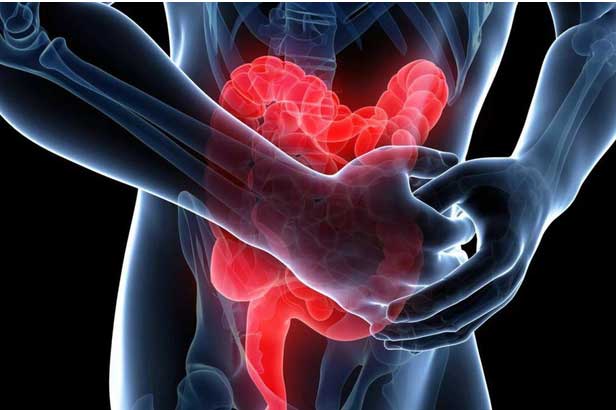 Đại trực tràng gửi tín hiệu này: Hãy nhanh chân đi kiểm tra trước khi tế bào ung thư lan rộng