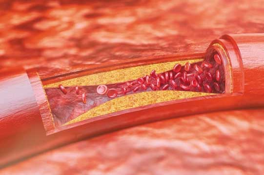 Cơ thể có 4 luôn chỗ "cứng" là dấu hiệu cảnh báo tuổi thọ ngắn, hy vọng bạn không mắc điểm nào
