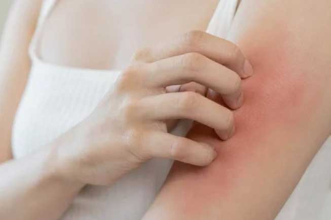 Dấu hiệu "2 ngứa 1 đen" trên cơ thể cảnh báo ung thư gan đang đứng "gõ cửa" nhà bạn