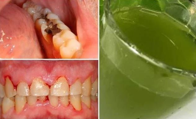Lấy nắm lá này xay lấy nước súc miệng hàng ngày khỏi lo đau nhức răng, viêm lợi