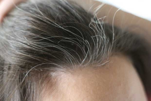 Chưa già đã thấy tóc bạc ở 3 vị trí này là dấu hiệu gan thận suy yếu