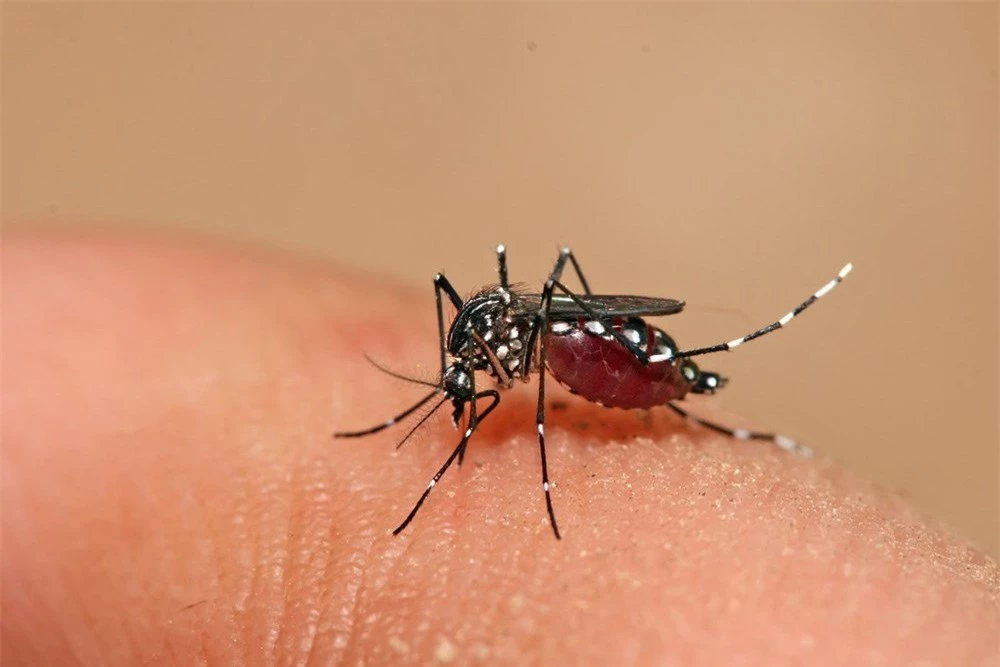 Cách giảm ngứa và sưng khi bị muỗi đốt cắn hiệu quả bất ngờ