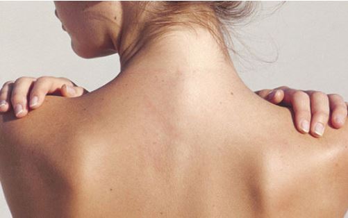 Bí quyết làm đẹp vùng da lưng