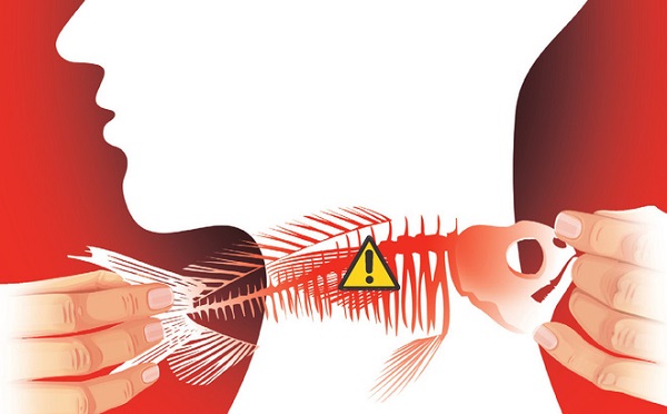 Hóc xương cá không còn là vấn đề đáng sợ nếu bạn biết mẹo vặt này