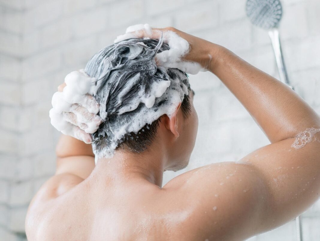 Căn bệnh có thể gây rụng tóc vĩnh viễn