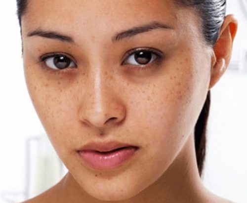 Những sai lầm khiến da mặt xấu đi