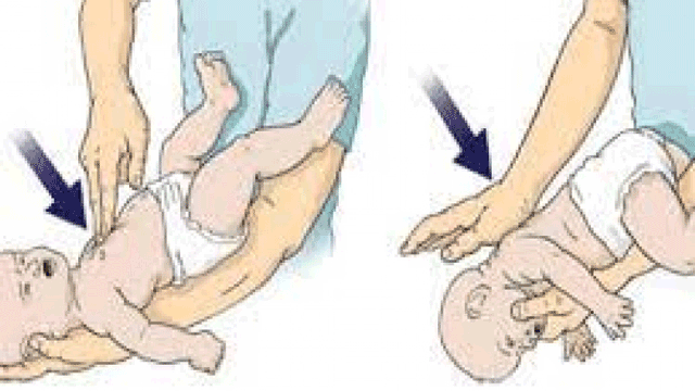 Cách sơ cứu trẻ sặc sữa tránh trường hợp tử vong đáng tiếc