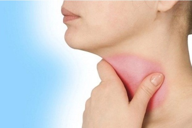 4 quy tắc để không bị viêm họng 'giày vò' trong mùa hè nắng nóng