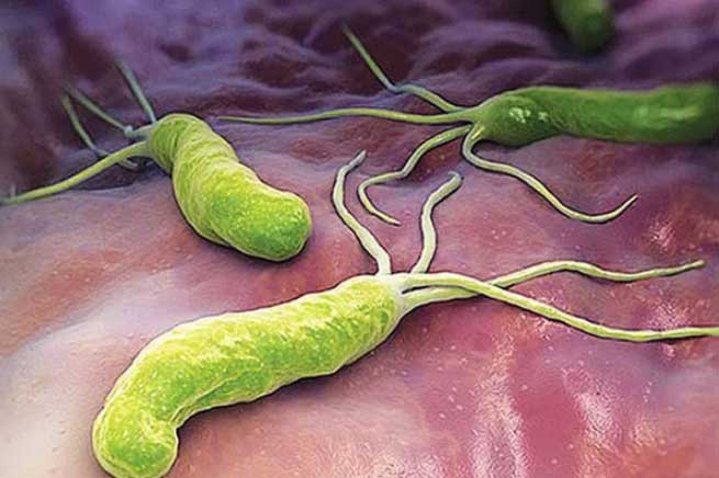 2 điều quyết định sự sống còn của vi khuẩn HP dạ dày: Chặn trước hay đi xạ trị cả đời do bạn chọn