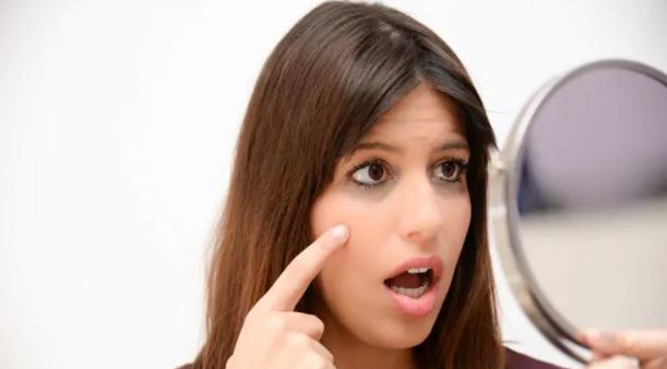 Trị quầng thâm mắt bằng dầu hạnh nhân và sữa lạnh