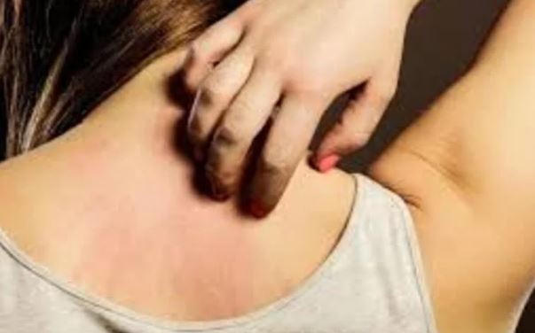 Ngứa liên tục '3 chỗ' trên cơ thể, đừng nghĩ là dị ứng, có thể lượng đường trong máu quá cao