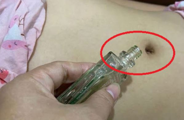 Nhỏ 1 giọt dầu gió vào rốn trước khi đi ngủ: Chỉ 3 ngày thấy ngay thay đổi