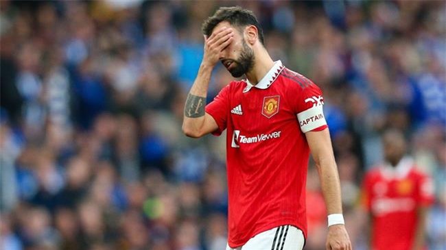 Bruno Fernandes dinh chan thuong mat ca truoc Brighton