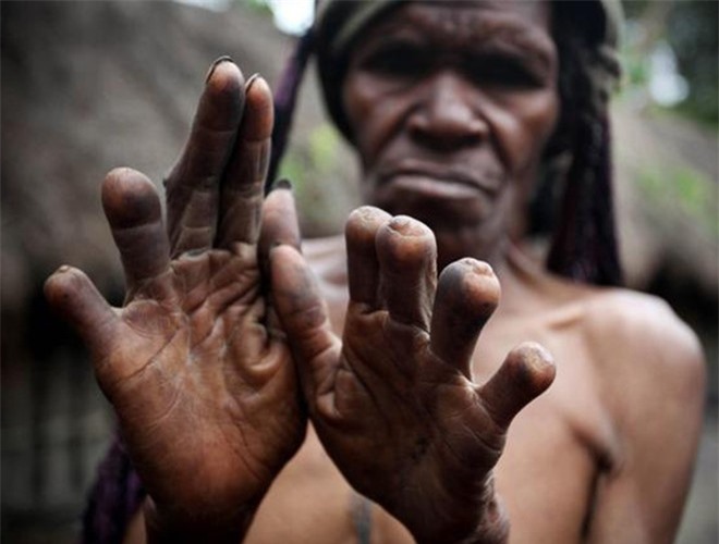 [ẢNH] Giật mình trước những phong tục kỳ lạ của các bộ tộc trên thế giới (phần 2) ảnh 1