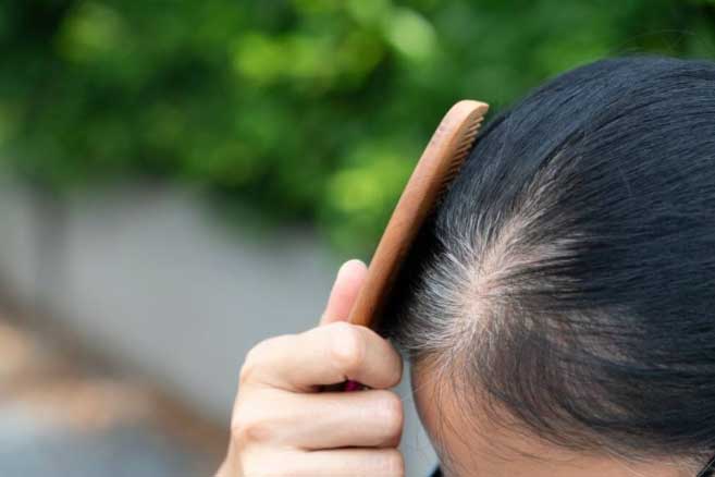 Tóc bạc sớm ở 3 vị trí này cảnh báo 3 cơ quan quan trọng đang suy yếu, đừng chủ quan