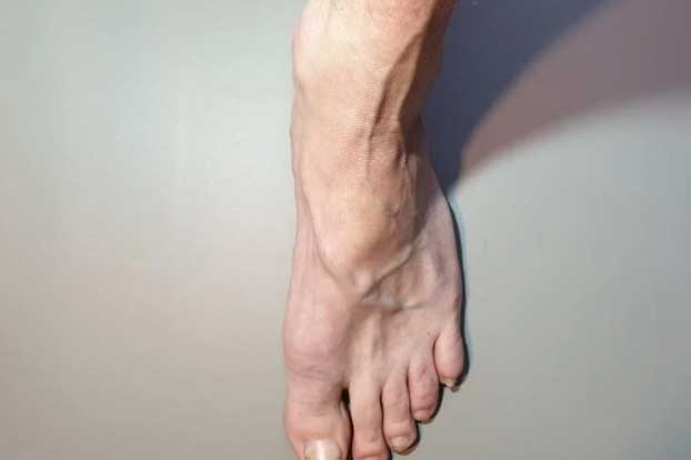 Phát hiện nổi gân xanh ở những vị trí này trên cơ thể cảnh báo mắc bệnh, tuyệt đối không nên chủ quan