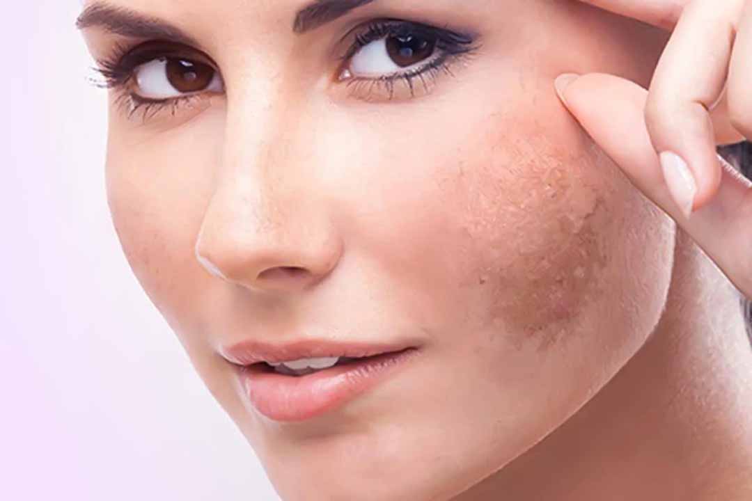 Những lý do bất ngờ khiến làn da xuống sắc