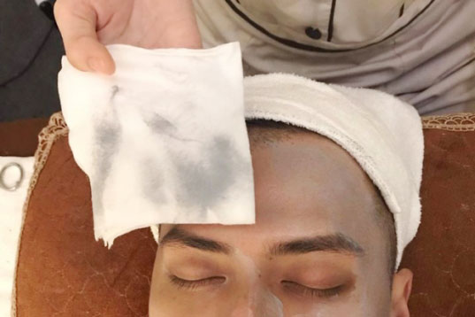 Hút chì thải độc cho da: 'Chiêu trò' câu khách!