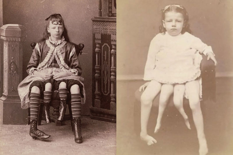 Cô gái 4 chân nổi tiếng như minh tinh, từng là niềm mơ ước của bao chàng trai 