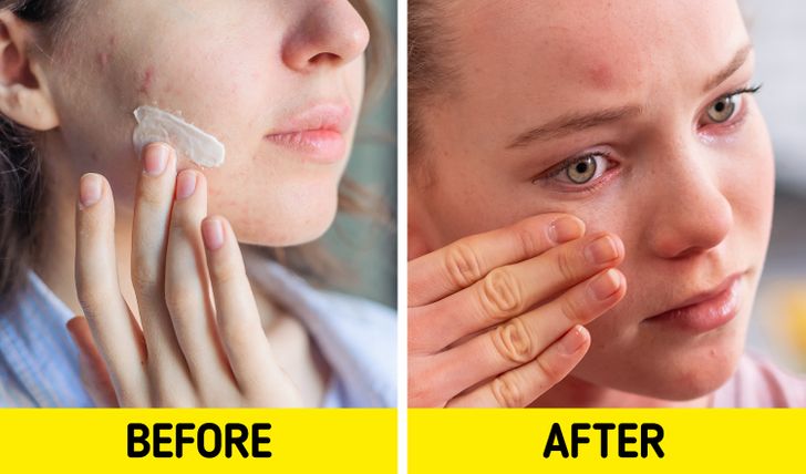 Loạt sản phẩm chăm sóc da phổ biến có thể gây hại nhiều hơn lợi