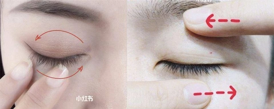 Đánh bay bọng mắt và quầng thâm sau 1 tuần với 5 cách không tốn 1 xu-7