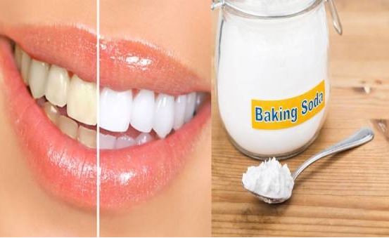 Bí quyết làm răng trắng tại nhà với baking soda