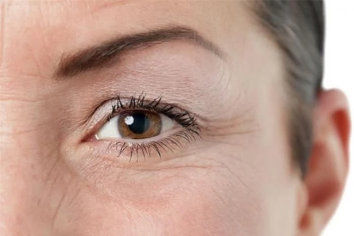 Tránh nheo mắt: Khi tuổi tác tăng, quá trình lão hóa diễn ra đồng nghĩa với độ đàn hồi của da không còn được tốt như xưa. Nheo mắt thường xuyên khiến các nếp gấp trên da không kịp đàn hồi, cuối cùng trở thành nếp nhăn. Ảnh minh họa