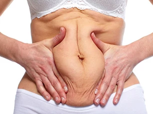 Những bước giúp hồi phục da bụng chảy xệ