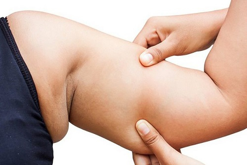 Những nguyên nhân khiến bắp tay của nhiều chị em tích mỡ