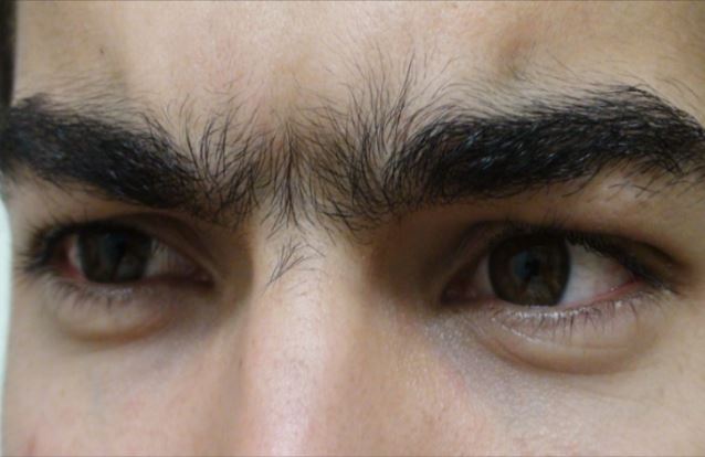 Người xưa dặn chẳng sai: Người lông mày rậm tràn xuống bờ mi nên tránh xa vì sao?