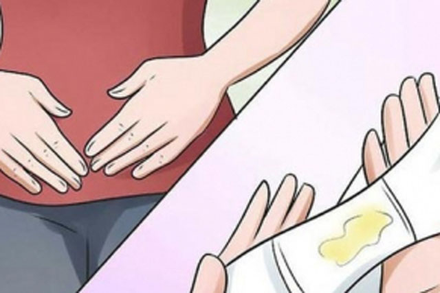 Quần lót ngày nào cũng giặt nhưng vẫn ố vàng, bác sĩ nói: 99% chị em mắc phải tật này