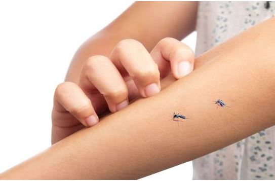 Nguyên nhân khiến bạn hay bị muỗi đốt hơn người khác