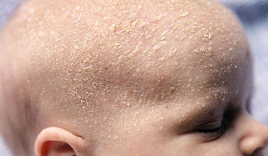 Những điều cần phải biết khi chọn dầu gội đầu cho trẻ nhỏ