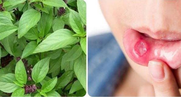 Một loại rau rẻ tiền giúp trị nhiệt miệng hiệu quả nhất