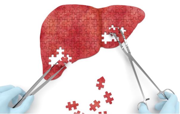 2 loại nước khiến gan tổn thương nhanh chóng, nhiều người ‘vô tư’ dùng giải khát mùa hè