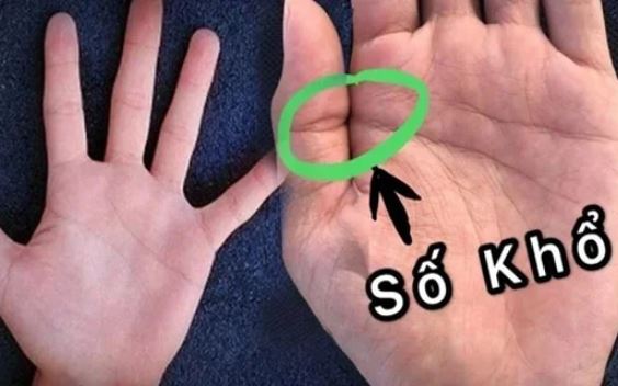 Người phúc mỏng, phận bạc thường có 5 đặc điểm trong lòng bàn tay, có 1 điểm thôi cũng đáng lo