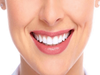 Thế nào là hàm răng đẹp tự nhiên? Cách sở hữu hàm răng đẹp đạt chuẩn