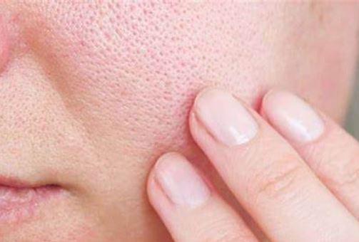 Thói quen hàng ngày khiến lỗ chân lông của bạn bị bít tắc