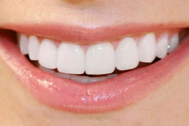 Chảy máu chân răng dấu hiệu của bệnh gì?