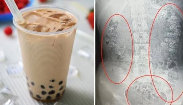 4 loại nước phá hủy gan thận của bạn, càng uống càng rút ngắn tuổi thọ