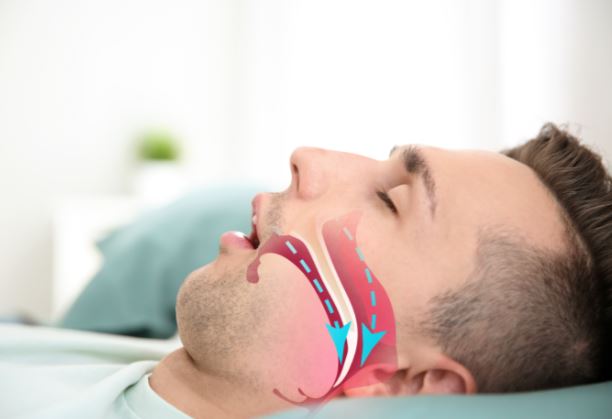 Ngủ chảy nước miếng là dấu hiệu của bệnh gì?